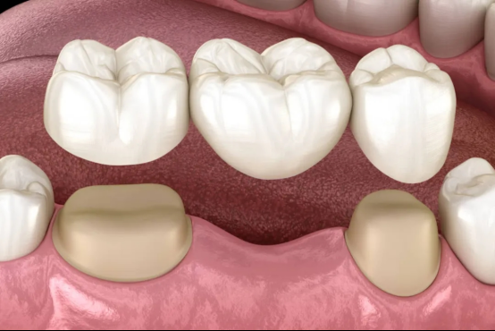 fe41c5a047a383b645a52e506eb6f33a.png fe41c5a047a383b645a52e506eb6f33a.png