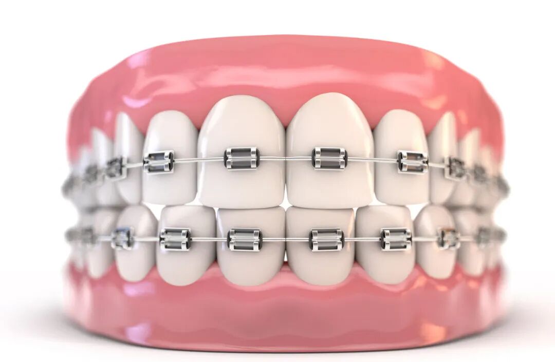 d384f8fadaed7c1614fe6b2551286193.jpg d384f8fadaed7c1614fe6b2551286193.jpg