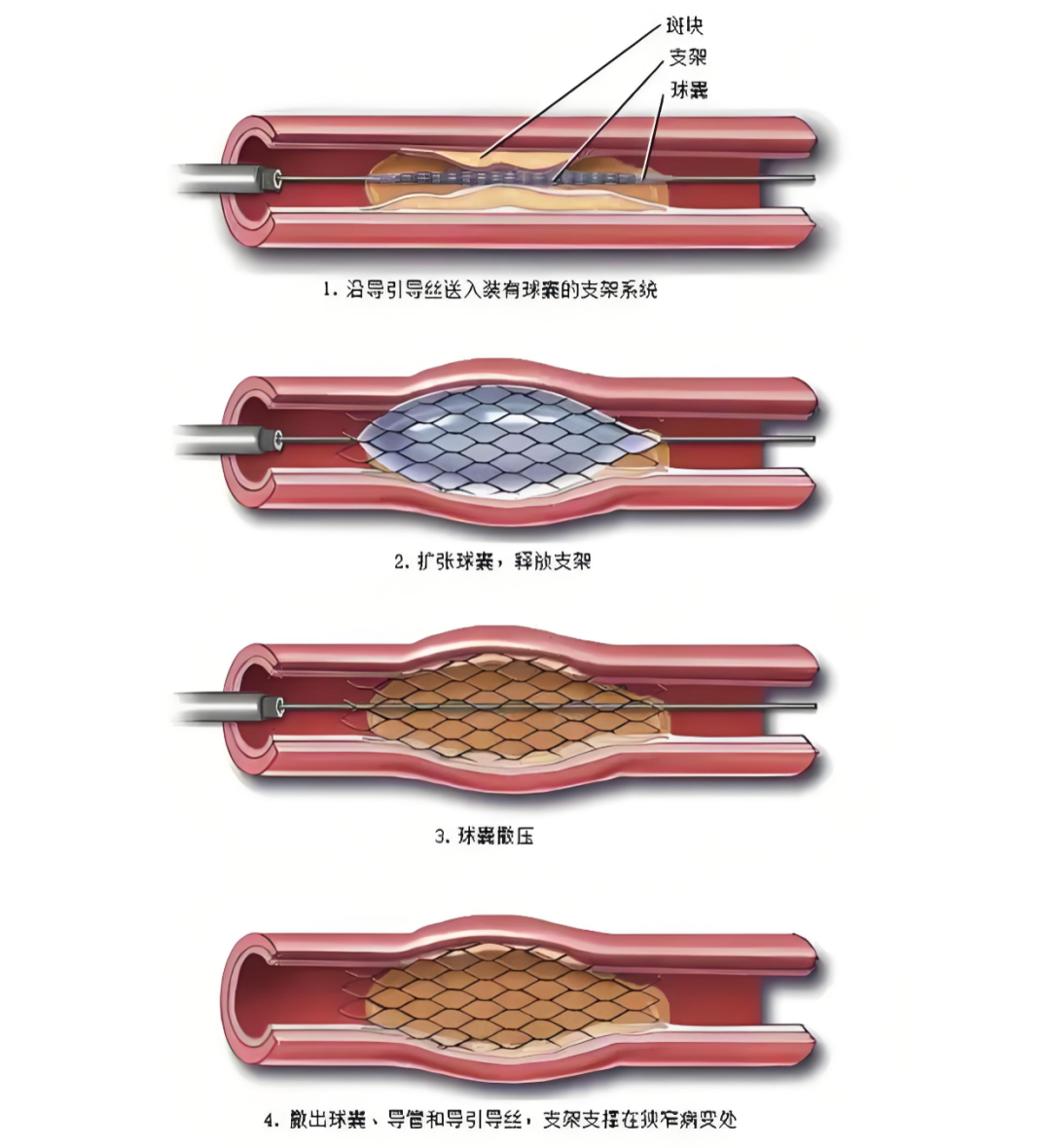 e132ea0609375f394b95f1962613ac15.png e132ea0609375f394b95f1962613ac15.png