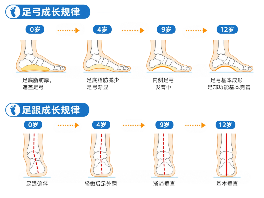 儿童足部发育示意图.png 儿童足部发育示意图.png