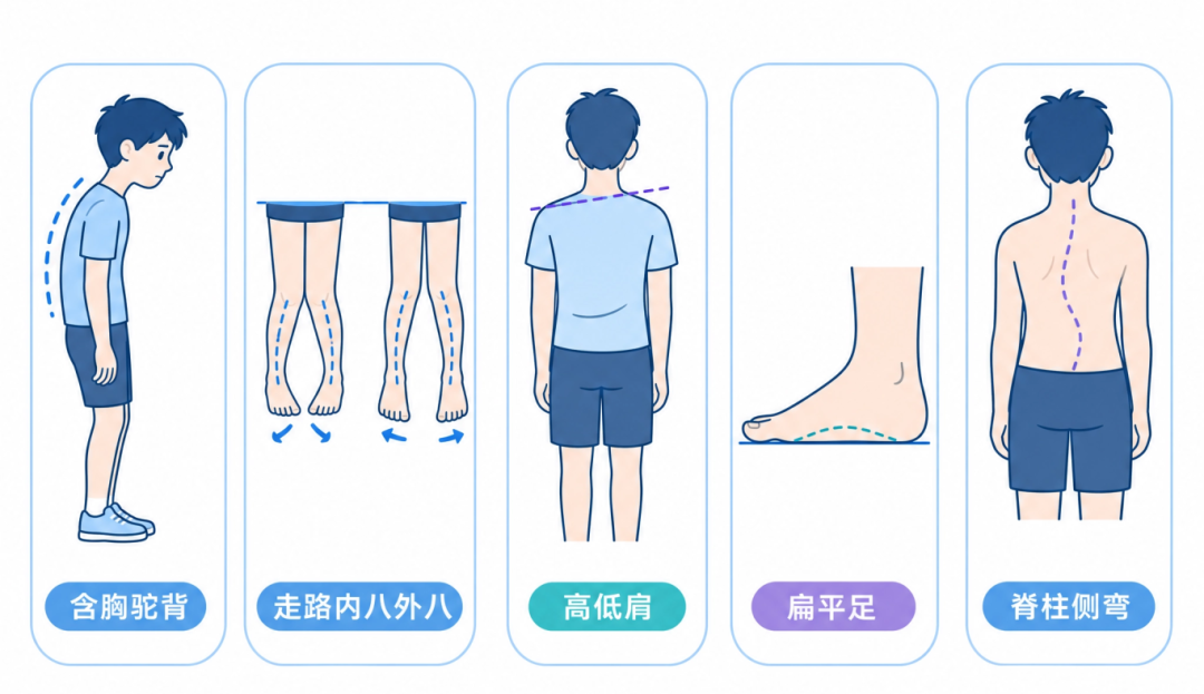 体态问题科普插图.png 体态问题科普插图.png