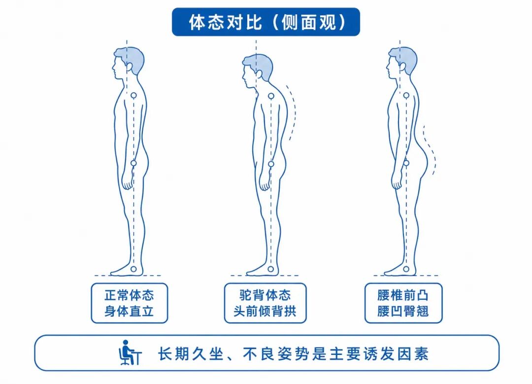 体态对比(侧面).jpg 体态对比(侧面).jpg