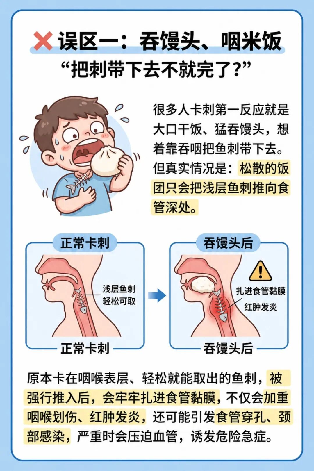 鱼刺卡喉处理指南.jpg 鱼刺卡喉处理指南.jpg