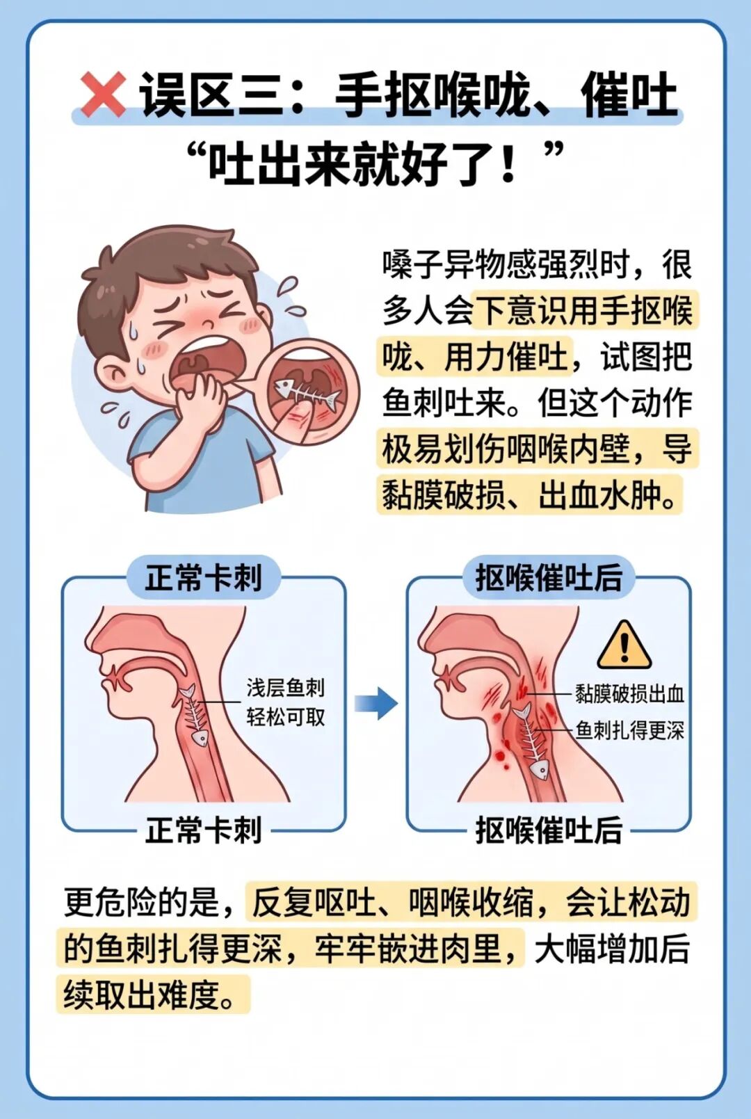 误区三:手抠喉咙、催吐 吐出来就好了! ❌ 误区三:手抠喉咙、催.jpg 误区三:手抠喉咙、催吐 吐出来就好了! ❌ 误区三:手抠喉咙、催.jpg